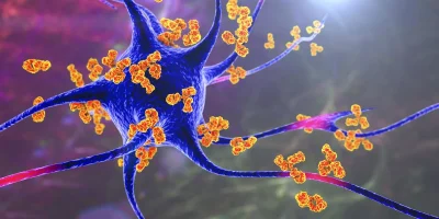 ARA-290 in Autoimmune Diseases